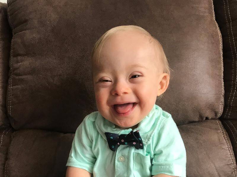 Lucas Warren, who has Down syndrome, is the face of baby food maker Gerber for 2018.