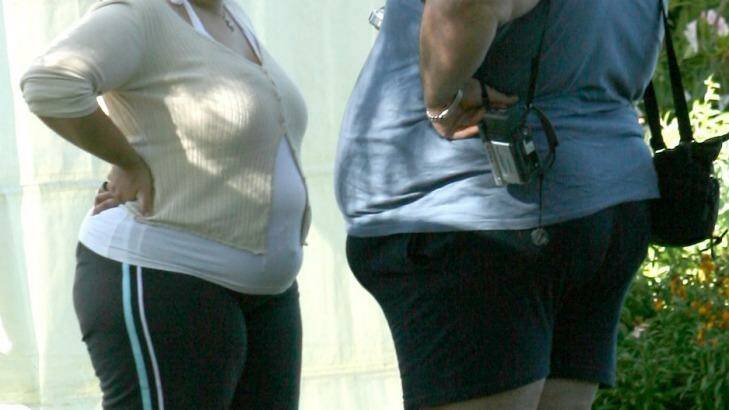 Obese and overweight patients over the age of 45 are costing the hospital system $4 billion per year, according to a study. Photo: Jim Rice