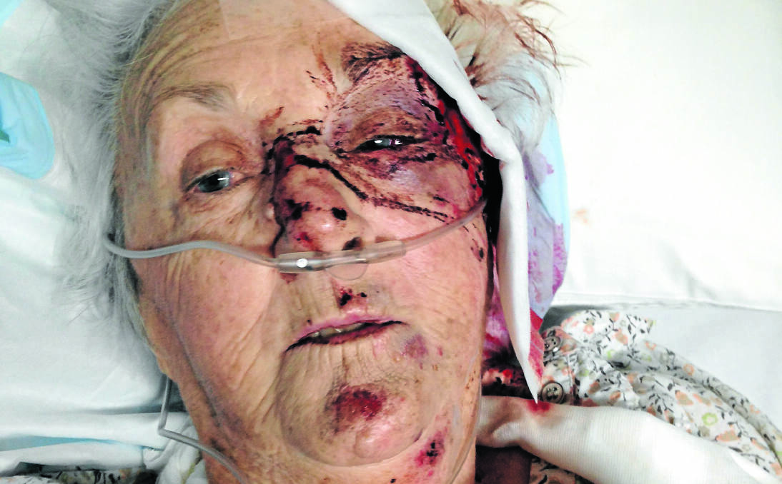 SLOW RECOVERY: 79-year-old Ursula Bakker remains in intensive care with serious injuries after she was robbed and fell to the ground in a car park.