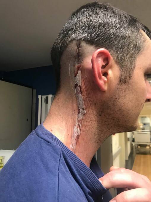 Fine line: Adam Brook discovered a melanoma just weeks before it became terminal, and now wants to spread the message of getting checked and taking action.