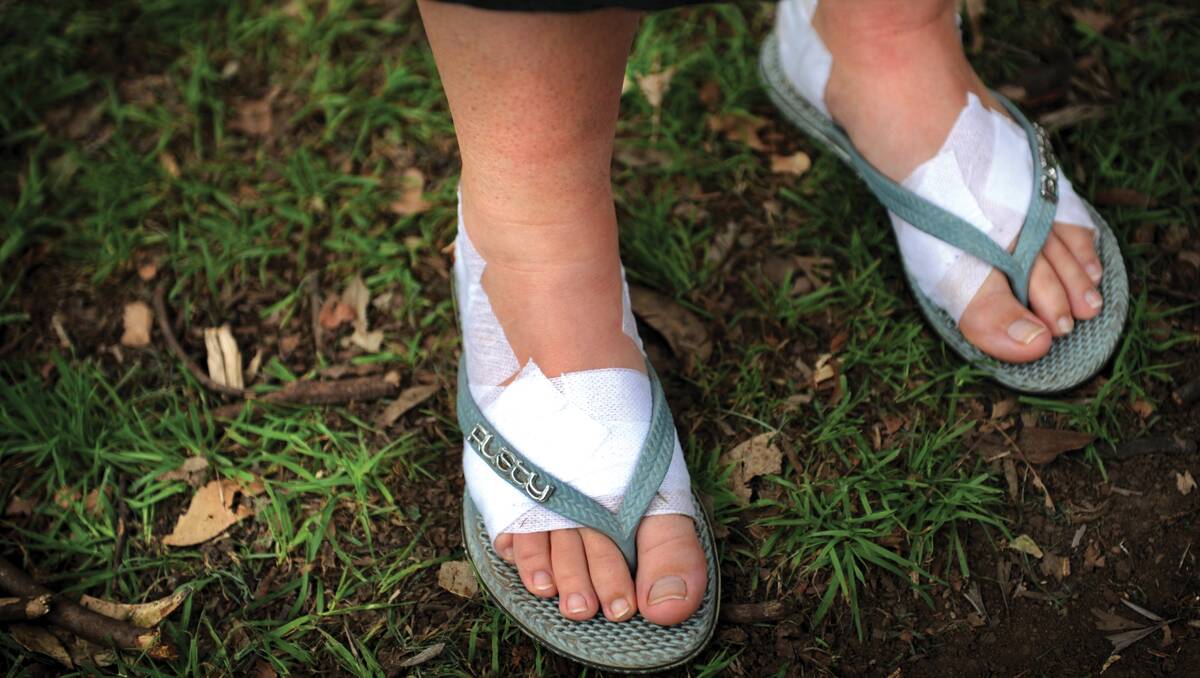 The bandages tell the story - the blistered feet of Oxley LAC Crime Prevention Officer Tracey Freeman. Photo: Marina Neil.